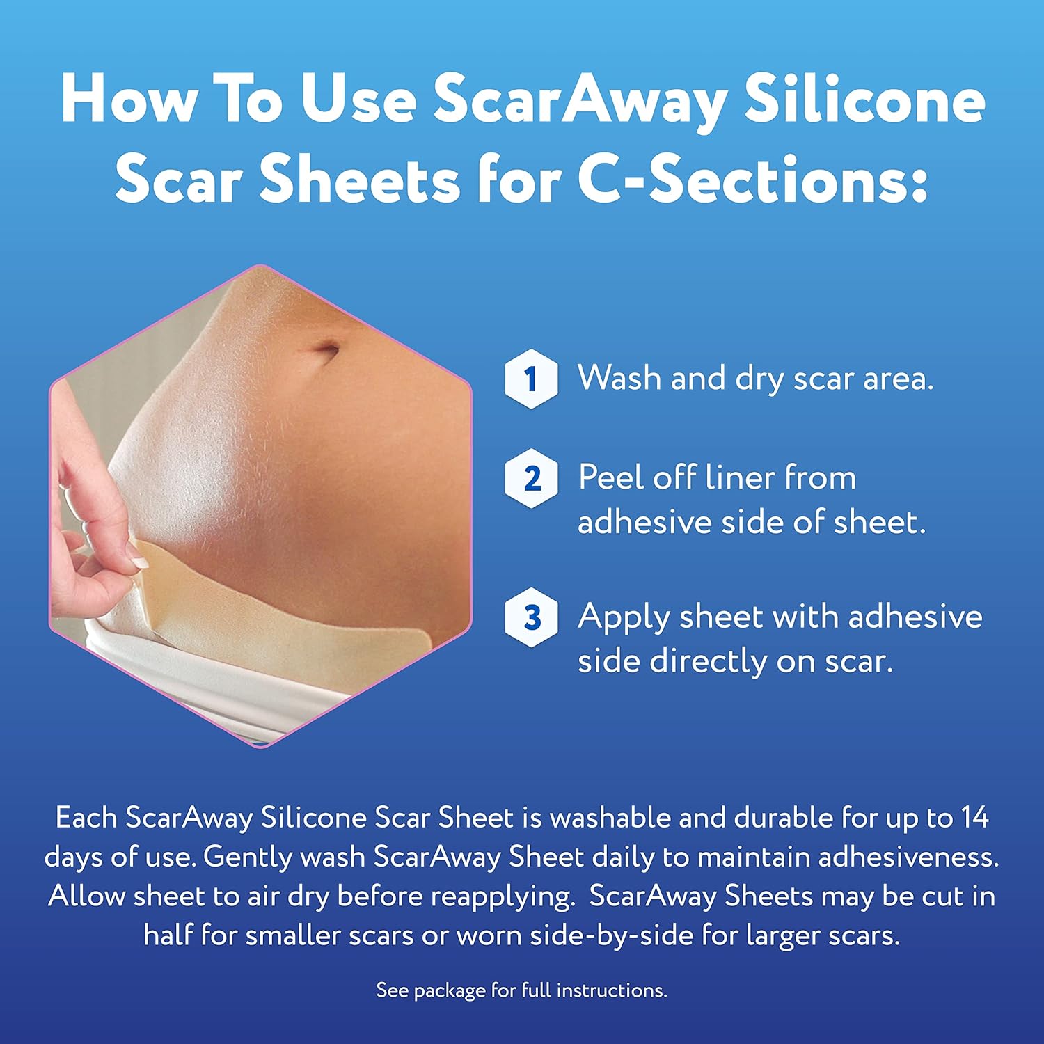 Reusable Silicone Scar Sheets (1.5” x 7”), 4 Sheets I2835