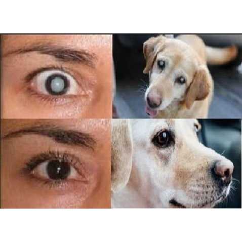 Cataract Eye Drops 4% NAC 2 x 10ml G73884