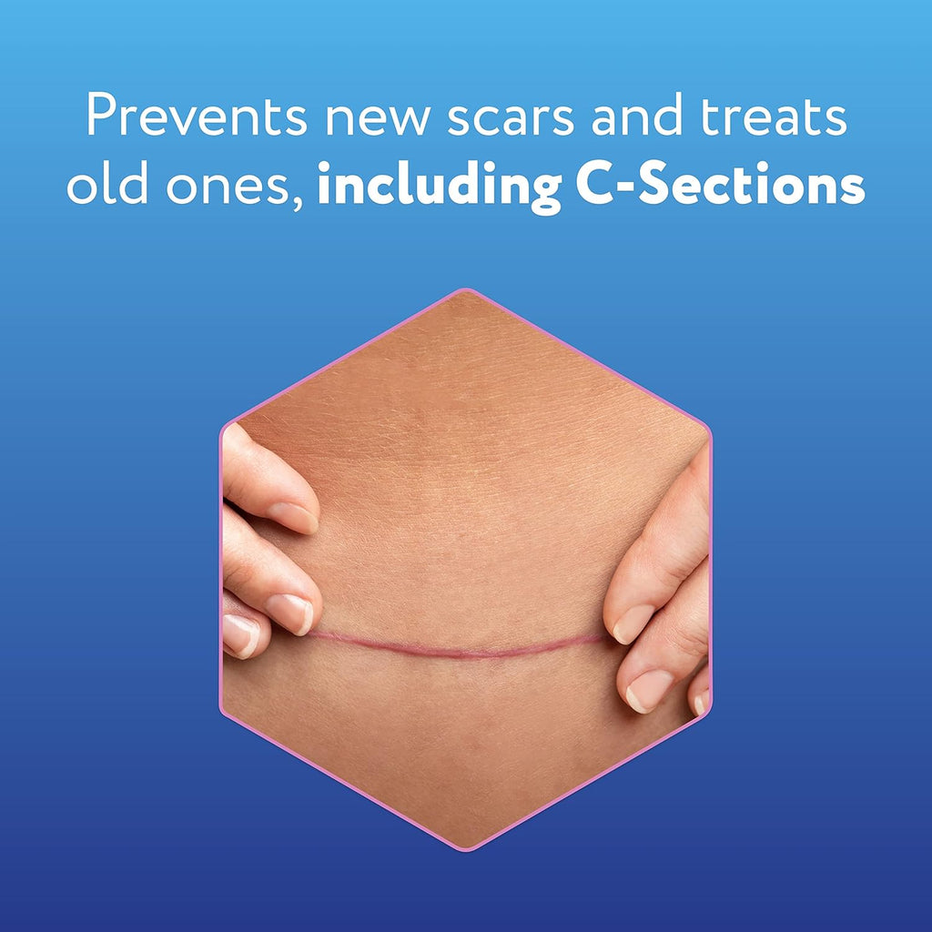 Reusable Silicone Scar Sheets (1.5” x 7”), 4 Sheets I2835
