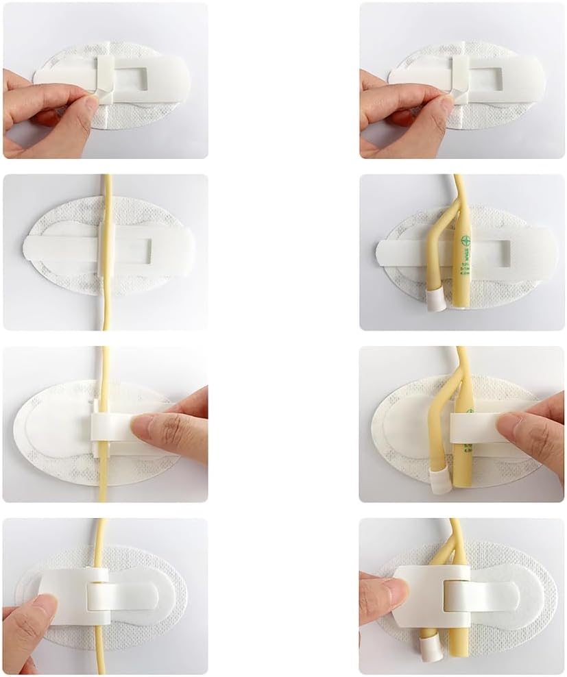 4 Pcs Adhesive Catheter Stabilization Device with Foam Anchor Pad N9746